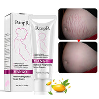 Mango stretch marks remover scar removal powerful postpartum obesity pregnancy cream Anti-Aging Anti Winkles Firming Body TSLM1 - DYALAK SHOP